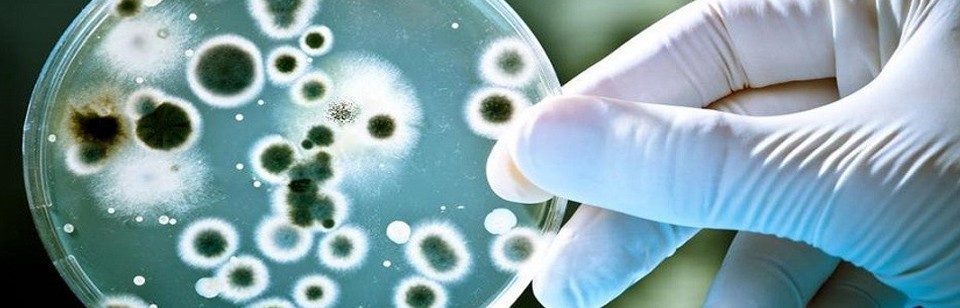 Infecciones Hongos - Bacterianas